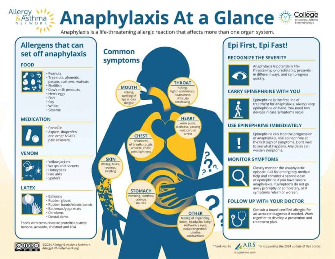 Anaphylaxis 6 Infographic titled "Anaphylaxis At a Glance" with sections on allergens, symptoms, and emergency actions. Includes images of foods, a human outline showing symptoms, and EpiPen instructions. Logos for Allergy & Asthma Network and ARS.